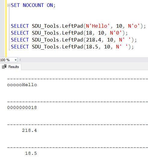 SDU Tools: LeftPad and RightPad in T-SQL (Right-align, Left-align)